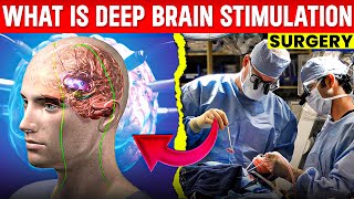 What is deep brain stimulation dbs  deep brain stimulation surgery  dbs surgery in hindi [upl. by Ainna]