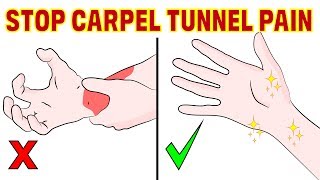 The 4 minute natural fix for carpal tunnel syndrome [upl. by Handal]