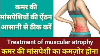 Homeopathic treatment for muscular dystrophy  मस्कुलर डिस्ट्रॉफी का इलाज होम्योपैथिक दवा से [upl. by Lance]