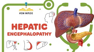 Hepatic Encephalopathy [upl. by Olwen]