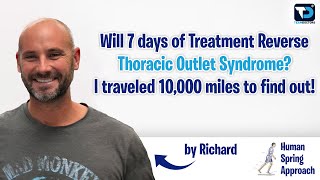 Severe Thoracic Outlet Syndrome Relief in Just 7 Days Richard’s Unbelievable Story [upl. by Teiluj]