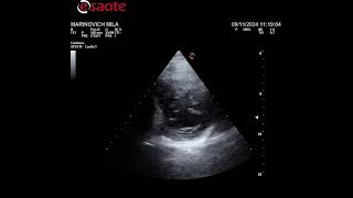 paraesternal eje corto nivel mitral [upl. by Roice29]