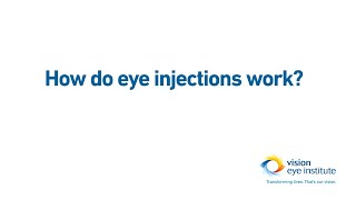 How do eye injections intravitreal injections work [upl. by Dibru797]