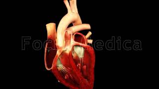 Atrial flutter  Animated Atlas of Atrial Fibrillation [upl. by Haisi465]