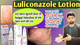 luliconazole lotion 1 wv uses in hindi lulifin lotion lulimac lotion [upl. by Akehsal]