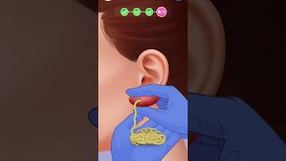 TreatmentA s m r☺️ asmr asmrsounds animation viralvideo gaming funnygame [upl. by Ahsehat234]