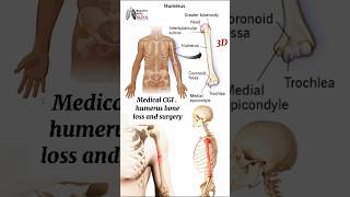 Medical CGI  humerus bone loss and surgery medical animation 3d short  BiologywithAliya [upl. by Coshow]