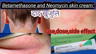 Betamethasone and Neomycin skin cream use in nepalibetnovate n cream useurticariapsoriasis treat [upl. by Ahsyla]