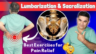 Unlocking Low Back Pain Relief Lumbrization of S1 amp Sacrilization of L5 Explained [upl. by Sonnie490]