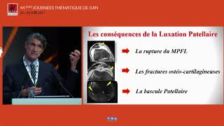 Dr David DEJOUR  LInstabilité patellaire objective  quel traitement [upl. by Travis]