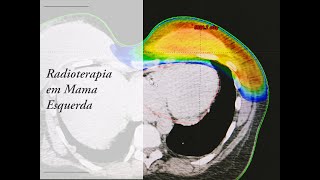 Radioterapia  Como funciona em nossas células [upl. by Yrahcaz881]