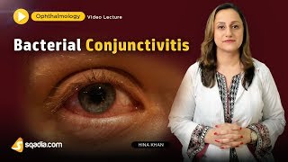 Bacterial Conjunctivitis  Ophthalmology Video Lecture  Medical Student VLearning [upl. by Eixid]