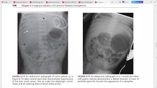 EMERGENCY RADIOLOGY REQUISITES [upl. by Soalokcin]