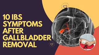 10 IBS Symptoms After Gallbladder Removal [upl. by Ahouh]