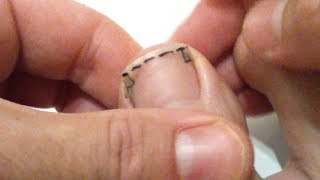 Tuto Comment bien se couper les ongles de pied pour éviter tout ongle incarné manière technique [upl. by Hinkel]