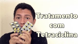 COMEÇANDO TRATAMENTO PARA ACNE COM TETRACICLINA  Tonzão Tivi [upl. by Brod]