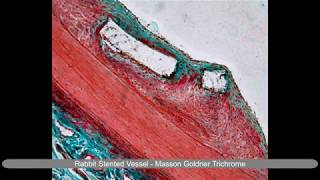 Laser Microtomy  Histological stains of undecalcified hard tissue and implanted tissue [upl. by Monahan]