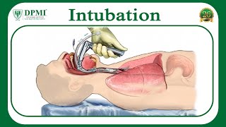 Intubation What is Intubation What conditions require Intubation Types of Intubation [upl. by Lyrehs736]