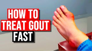 How To Treat Gout in 2024 [upl. by Ilka]