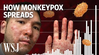 Why Monkeypox Is a Global Health Threat  WSJ [upl. by Socin]