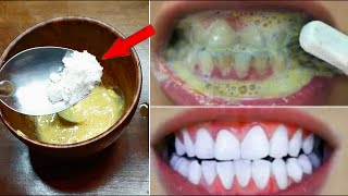 Teeth whitening at home in 3 minutes  How to naturally whiten your yellow teeth  100 effective [upl. by Yanaton]