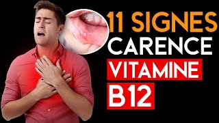 11 Signes et Symptômes les plus fréquents dune Carence en Vitamine B12 que VOUS DEVEZ Connaître [upl. by Aymahs]