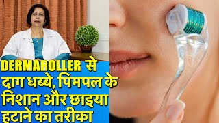 Dermaroller  DIY  डर्मा रोलर से दाग धब्बे झुर्रियाँ ओपन पोर्स आदि का इलाज [upl. by Noedig]