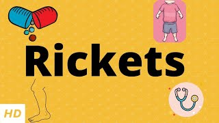 Rickets Causes Signs and Symptoms Diagnosis and Treatment [upl. by Trocki]