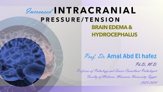 Increased ICP lecture hydrocephalus and edema 1CNS HUشرح محاضرة [upl. by Netnerb932]