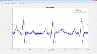 Signal Processing with MATLAB [upl. by Verneuil]