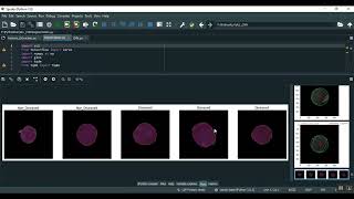 An Automatic Malaria Disease Diagnosis Framework Integrating Blockchain Enabled Cloud–Edge Computing [upl. by Aehtrod]