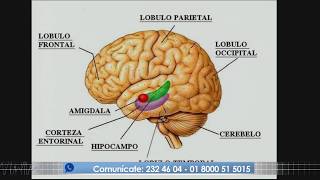 Cuidado y manejo en casa de pacientes con alzheimer  Su Médico en Casa [upl. by Ellegna598]