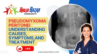 Pseudomyxoma Peritonei Explained Symptoms Treatment and Care 🏥  Rare Abdominal Condition [upl. by Thoma250]