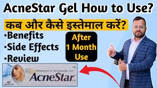 Acne Star Gel  Acne Star Gel Price  Acne Star Gel Review  Acne Star Gel Uses  Review king [upl. by Lindly]