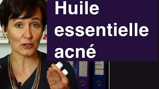 Huile essentielle acné  laquelle préférer [upl. by William677]