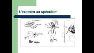 GYNECOLOGIE L’examen en gynécologie [upl. by Meehyr967]