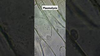 Plasmolysis and Osmosis biology gcse [upl. by Waterman572]