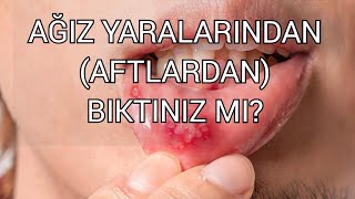 Aftlar Ağız yaraları için merak edilen gargara formülü Kendiniz yapabilirsiniz [upl. by Haldi]