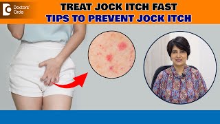 Jock Itch Tinea Cruris Best ways to avoid Itching Down There  Dr Rasya Dixit Doctors Circle [upl. by Namielus]