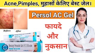 Persol ac gel 25  Benzoyl Peroxide gel 25  Benzoyl Peroxide For Acne  by Drx Pranjali Satpute [upl. by Ling904]