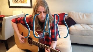 Scars  James Bay cover by Emma Beckett [upl. by Nosmoht]