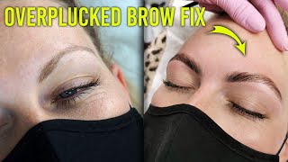 My Secret Weapon for Fixing Overplucked Thin Brows One Time Treatment [upl. by Dyolf]