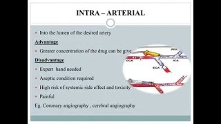 Intra Arterial Route of Drug Administration Injection [upl. by Fernando]