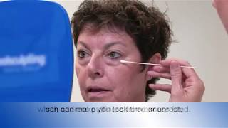 What happens during a lower eyelid surgery [upl. by Hephzibah]