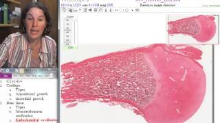 Popular Classic F13 Endochondral ossification [upl. by Oaoj]