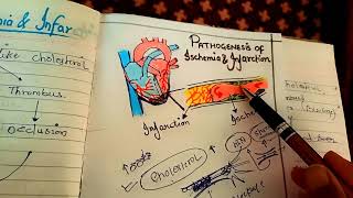 pathogenesis of ischemia and infarction NGMedicals [upl. by Alane]