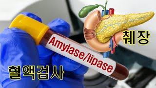 혈액검사  Amylase Lipase  췌장수치 [upl. by Nnaik]