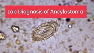 Lab diagnosis and prevention form Ancylostoma duodenale II Necator Americanus [upl. by Weaver]