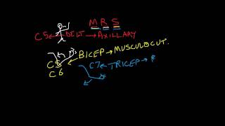 Nerve Root vs Peripheral Nerve 2 of 2 motor complaints upper extremity [upl. by Eillod750]