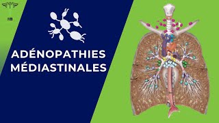 Adénopathies Médiastinales Rappel Anatomique  Diagnostique Positif  Etiologies  Traitement [upl. by Letti]